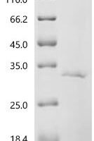 Plutella xylostella NADH dehydrogenase [ubiquinone] 1 beta subcomplex subunit 9 , partial Recombinant Protein - BioCrest Sci