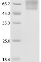 Human RecQ-like DNA helicase BLM (BLM), partial Recombinant Protein, C-10His - BioCrest Sci