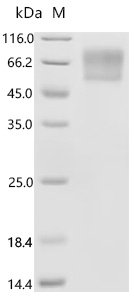 Human RecQ-like DNA helicase BLM (BLM), partial Recombinant Protein, C-10His, Homo sapiens (Human), Mammalian cell, C-terminal 10xHis-tagged, 35.6 kDa, purity >≥ 95% as determined by SDS-PAGE.