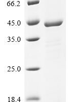 Transcriptional regulatory protein CpxR (cpxR) Recombinant Protein - BioCrest Sci