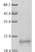 Influenza A virus Matrix protein 2 (M), partial Recombinant Protein, N-10His-SUMO/C-Myc - BioCrest Sci