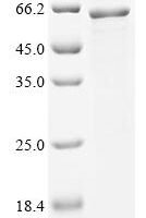 Human Thioredoxin-interacting protein (TXNIP),Escherichia Coli Recombinant Protein - BioCrest Sci