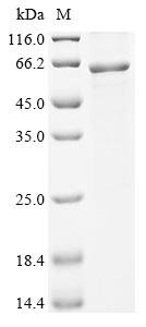 Human Thioredoxin-interacting protein (TXNIP),Escherichia Coli Recombinant Protein, Homo sapiens (Human), E.coli, N-terminal 6xHis-B2M-tagged, 58.2 kDa, purity >≥ 85% as determined by SDS-PAGE.