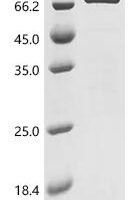 Mouse Endoplasmic reticulum chaperone BiP (Hspa5) Recombinant Protein - BioCrest Sci