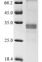 Mouse Membrane-spanning 4-domains subfamily A member 6D (Ms4a6d) Recombinant Protein - BioCrest Sci
