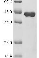Staphylococcus aureus Phospholipase C (hlb) Recombinant Protein, C-His - BioCrest Sci