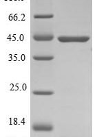 Mouse Protein atonal homolog 1 (Atoh1) Recombinant Protein - BioCrest Sci