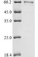 Human Heterogeneous nuclear ribonucleoprotein K (HNRNPK), partial Recombinant Protein, C-His - BioCrest Sci
