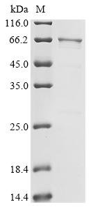 Human Heterogeneous nuclear ribonucleoprotein K (HNRNPK), partial Recombinant Protein, C-His, Homo sapiens (Human), E.coli, C-terminal 6xHis-tagged, 57.2 kDa, purity >≥ 85% as determined by SDS-PAGE.