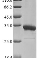 HDV Large delta antigen Recombinant Protein - BioCrest Sci