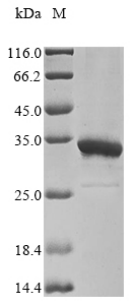 HDV Large delta antigen Recombinant Protein, Hepatitis delta virus genotype I (isolate Italian) (HDV), Mammalian cell, N-terminal 10xHis-tagged and C-terminal Myc-tagged, 29.1 kDa, purity >≥ 85% as determined by SDS-PAGE.