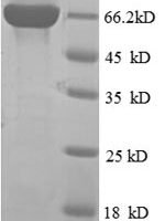 Human Inactive phospholipase D5 (PLD5) Recombinant Protein - BioCrest Sci