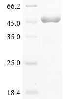 Human N-myc-interactor (NMI), partial Recombinant Protein - BioCrest Sci