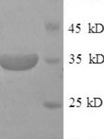 Mouse Membrane cofactor protein (Cd46), partial Recombinant Protein - BioCrest Sci