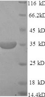 Mouse Membrane cofactor protein (Cd46), partial Recombinant Protein, Mus musculus (Mouse), E.coli, N-terminal 6xHis-tagged, 35.9 kDa, purity >≥ 90% as determined by SDS-PAGE.