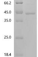 Human Prohibitin-2 (PHB2) Recombinant Protein, C-His - BioCrest Sci