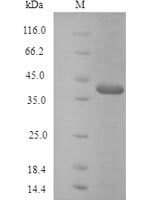 Human Protein atonal homolog 1 (ATOH1) Recombinant Protein, N-His - BioCrest Sci