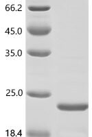 Human Apolipoprotein A-V (APOA5), partial Recombinant Protein - BioCrest Sci