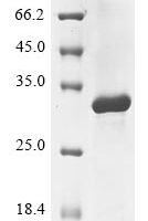 Anemonia sulcata GFP-like non-fluorescent chromoprotein FP595 Recombinant Protein, N-GST - BioCrest Sci