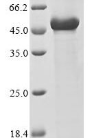 Human CUGBP Elav-like family member 1 (CELF1) (T173E,S178D,S285D,S288D,S295D,S296D,S298D), partial Recombinant Protein - BioCrest Sci