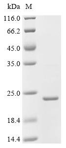 Bacillus phage phi29 Single-stranded DNA-binding protein (5) Recombinant Protein, Bacillus phage phi29 (Bacteriophage phi-29), E.coli, C-terminal 6xHis-tagged, 20.3 kDa, purity >≥ 90% as determined by SDS-PAGE.
