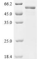 Human E3 ubiquitin-protein ligase RNF128 (RNF128), partial Recombinant Protein - BioCrest Sci