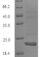 Mouse B-lymphocyte antigen CD20 (Ms4a1), partial Recombinant Protein, N-His - BioCrest Sci
