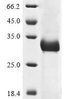 Human coronavirus OC43 Spike glycoprotein (S), partial Recombinant Protein, C-His - BioCrest Sci