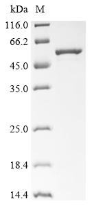 Human Melanoma-associated antigen B1 (MAGEB1) Recombinant Protein, Homo sapiens (Human), E.coli, N-terminal 10xHis-tagged and C-terminal Myc-tagged, 46.5 kDa, purity >≥ 85% as determined by SDS-PAGE.