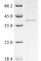 Human Hydroxycarboxylic acid receptor 2 (HCAR2) Recombinant Protein - BioCrest Sci