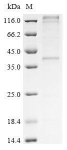 Human Hydroxycarboxylic acid receptor 2 (HCAR2) Recombinant Protein, Homo sapiens (Human), in vitro E.coli expression system, C-terminal 6xHis-tagged, 42.7 kDa, purity >≥ 85% as determined by SDS-PAGE.