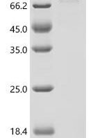 Mouse Leucine zipper putative tumor suppressor 1 (Lzts1) Recombinant Protein - BioCrest Sci