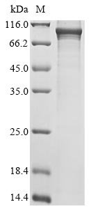 Rat Calcium calmodulin-dependent 3,5 cyclic nucleotide phosphodiesterase 1C (Pde1c) Recombinant Protein, Rattus norvegicus (Rat), E.coli, N-terminal 6xHis-tagged, 92.6 kDa, purity >≥ 85% as determined by SDS-PAGE.