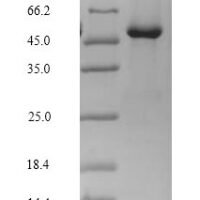 Rat Lutropin-choriogonadotropic hormone receptor (Lhcgr), partial Recombinant Protein, C-Flag, aa 27–362, Mammalian cell - BioCrest Sci