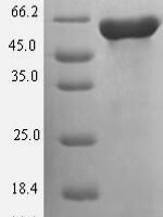 Human Guanine nucleotide-binding protein G (s) subunit alpha isoforms short (GNAS) Recombinant Protein - BioCrest Sci