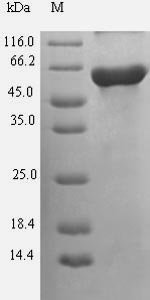 Human Guanine nucleotide-binding protein G (s) subunit alpha isoforms short (GNAS) Recombinant Protein, Homo sapiens (Human), E.coli, N-terminal 6xHis-SUMO-tagged, 61.7 kDa, purity >≥ 90% as determined by SDS-PAGE.