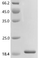 Human Uncharacterized protein C17orf67 (C17orf67) Recombinant Protein - BioCrest Sci