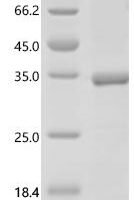 Human Nuclear pore complex protein Nup153 (NUP153), partial Recombinant Protein, C-His - BioCrest Sci