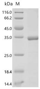 Human Nuclear pore complex protein Nup153 (NUP153), partial Recombinant Protein, C-His, Homo sapiens (Human), E.coli, C-terminal 6xHis-tagged, 30.2 kDa, purity >≥ 85% as determined by SDS-PAGE.
