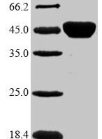Mycobacterium kansasii Diacylglycerol acyltransferase/mycolyltransferase Ag85B (fbpB) Recombinant Protein - BioCrest Sci