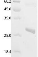 Sesamum indicum  2S albumin (LOC105174067) Recombinant Protein - BioCrest Sci