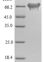 Escherichia coli L-aspartate oxidase (nadB) Recombinant Protein - BioCrest Sci