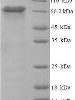 Human Probable serine carboxypeptidase CPVL (CPVL) Recombinant Protein - BioCrest Sci