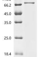 Human Succinate dehydrogenase [ubiquinone] flavoprotein subunit, mitochondrial (SDHA), partial Recombinant Protein, C-His - BioCrest Sci