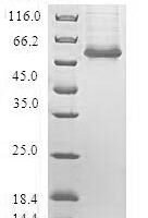 Human Cyclic AMP-responsive element-binding protein 3-like protein 2 (CREB3L2) Recombinant Protein - BioCrest Sci