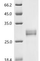 Human Ras-related protein Rab-5C (RAB5C) Recombinant Protein, C-10His - BioCrest Sci
