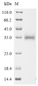 Severe acute respiratory syndrome coronavirus Spike glycoprotein (S), partial Recombinant Protein, Severe acute respiratory syndrome coronavirus (SARS-CoV), Mammalian cell, C-terminal 6xHis-tagged, 27.2 kDa, purity >≥ 90% as determined by SDS-PAGE.
