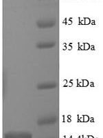 Human Caspase-7 (CASP7), partial Recombinant Protein - BioCrest Sci