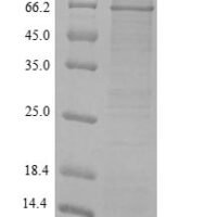 Rat 72 kDa type IV collagenase (Mmp2) Recombinant Protein, N-His, aa 110–662, Yeast - BioCrest Sci