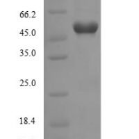 Human Protein Wnt-7b (Wnt7B) Recombinant Protein - BioCrest Sci